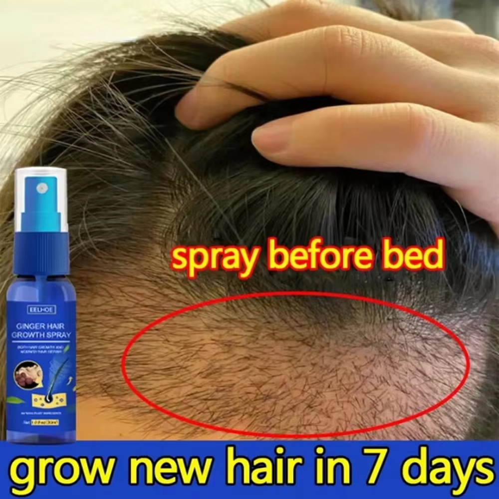 Hair Care Lotion - Fast Ginger Hair Growth Spray Roots