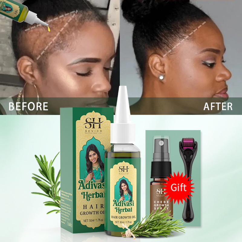 Ayurvedic Hair Growth Oil Indi - đánh giá và giá Hair Care Essence Oil Spray