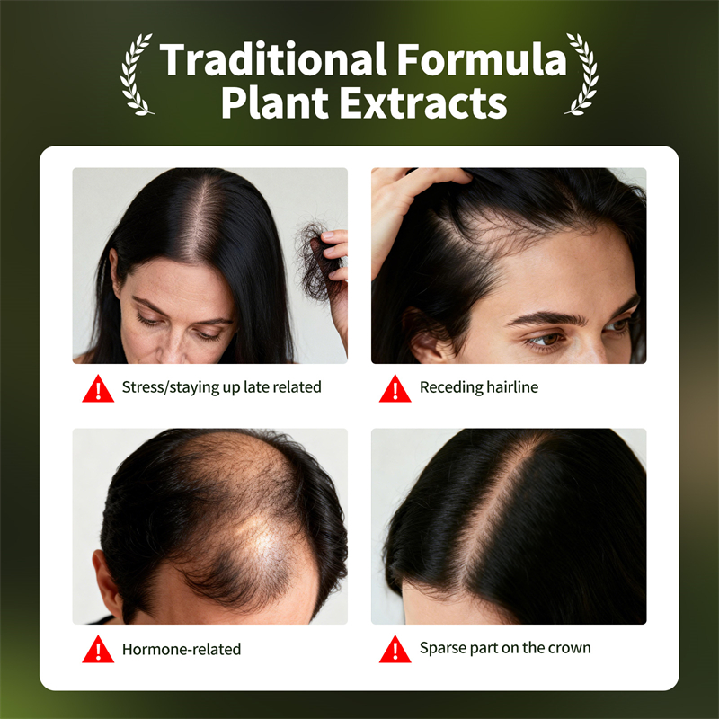 Natural Hair Growth Set Usman  - đánh giá và giá Hair Care Essence Oil Spray