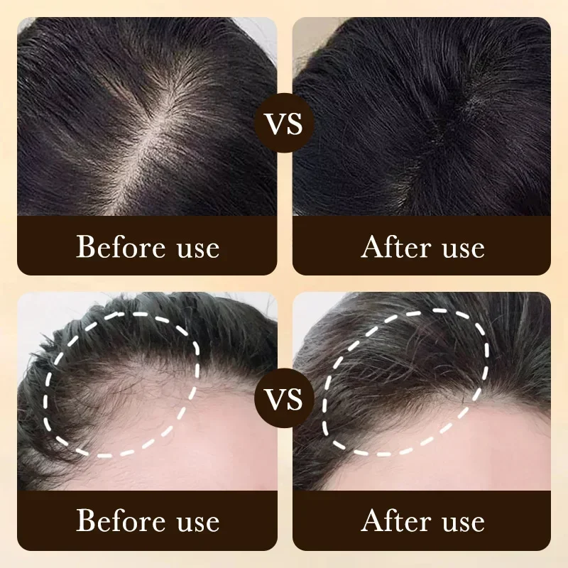 Biotin Fast Hair Growth Oil Pr - đánh giá và giá Hair Care Essence Oil Spray