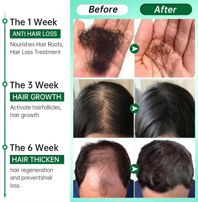 Hair Growth Serum 7 Days Fast  - đánh giá và giá Hair Care Capsule