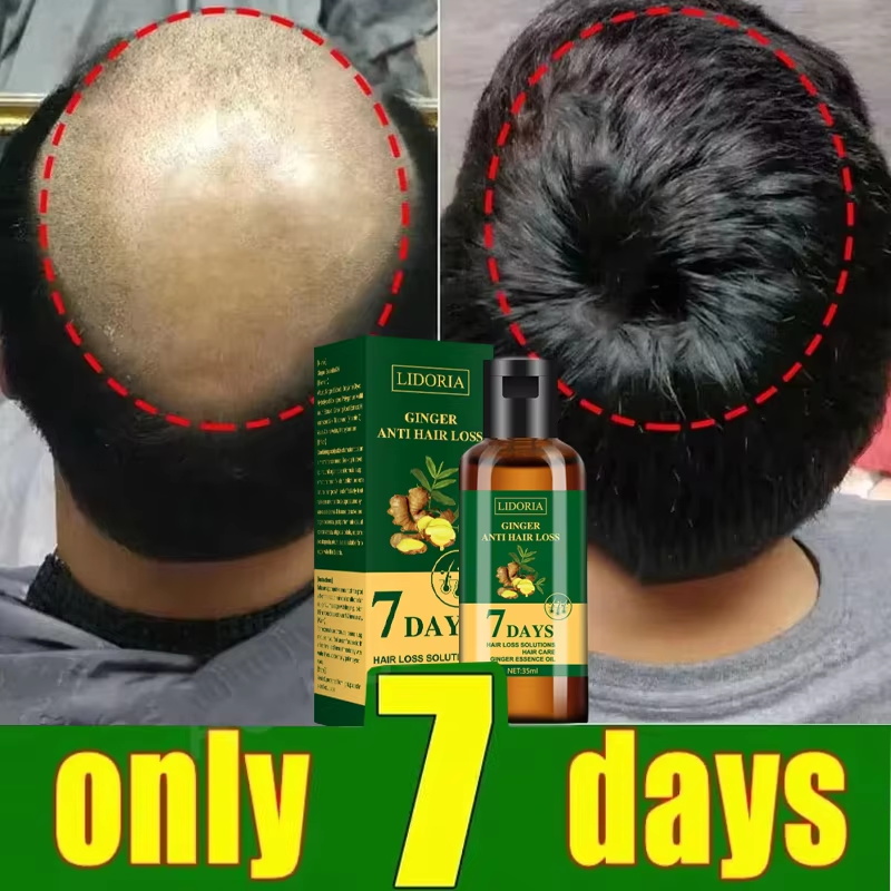 Hair Growth Serum 7 Days Fast  - đánh giá và giá Hair Care Capsule