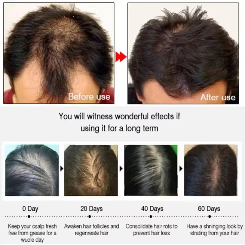 Hair Growth Serum 7 Days Fast  - đánh giá và giá Hair Care Capsule
