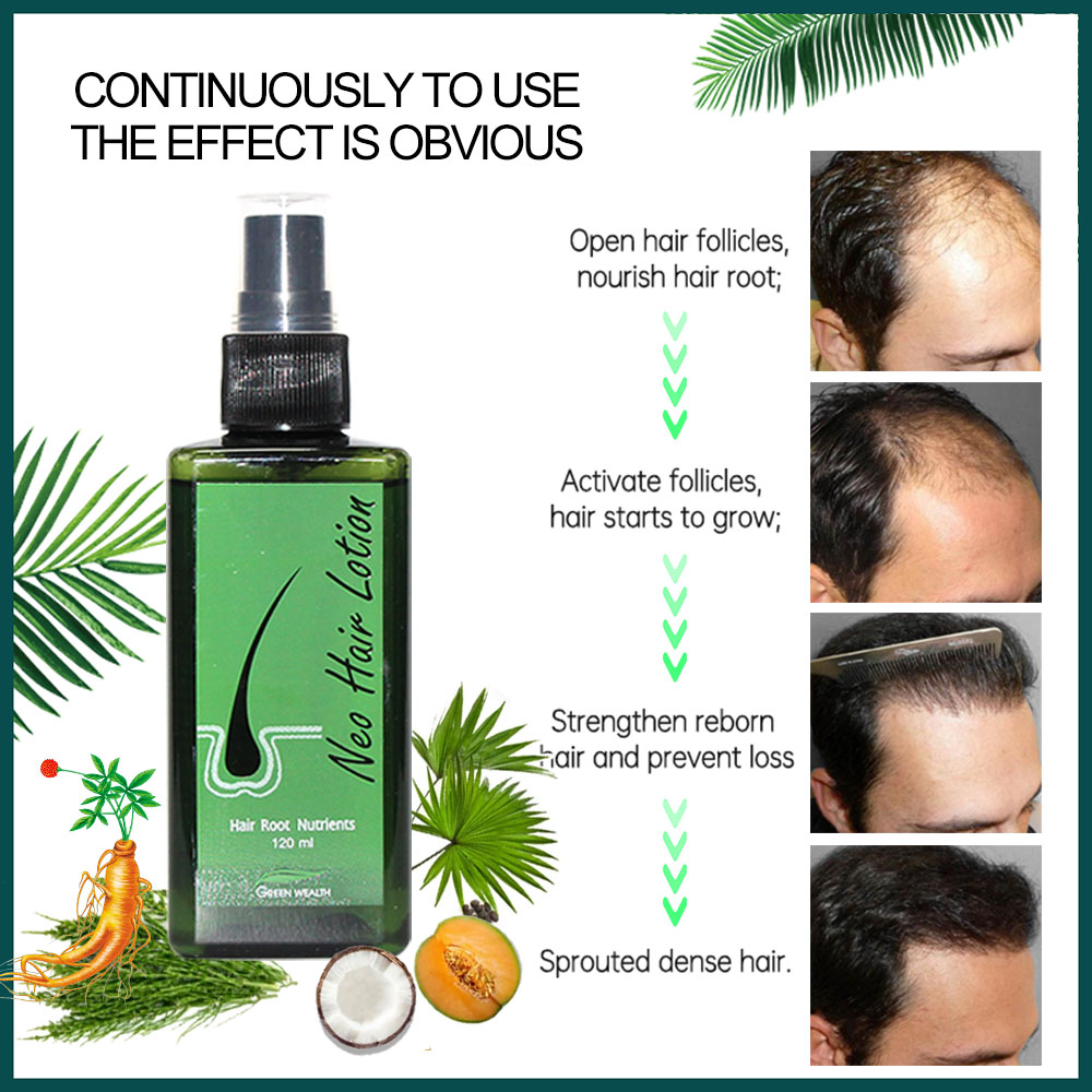 Neo Tóc 120Ml Tóc Điều Trị Tận - đánh giá và giá Hair Care Thailand
