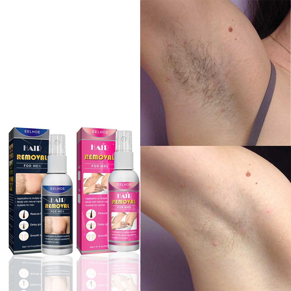 1/2PCS Super Natural Painless  - đánh giá và giá Hair Care Lotion