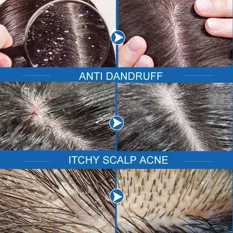 Fast Anti Dandruff Hair Treatm - đánh giá và giá Hair Care Dandruff