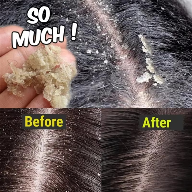 Fast Anti Dandruff Hair Treatm - đánh giá và giá Hair Care Dandruff