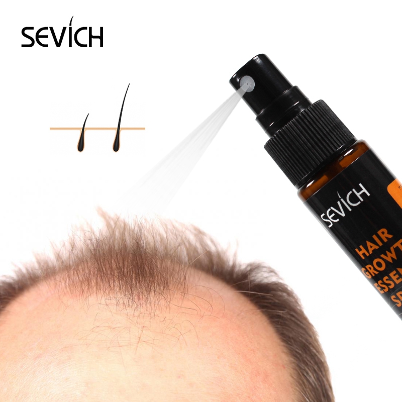 Sevich 30Ml Hebal Tinh Chất Dầ - đánh giá và giá Hair Care Essence Oil Spray