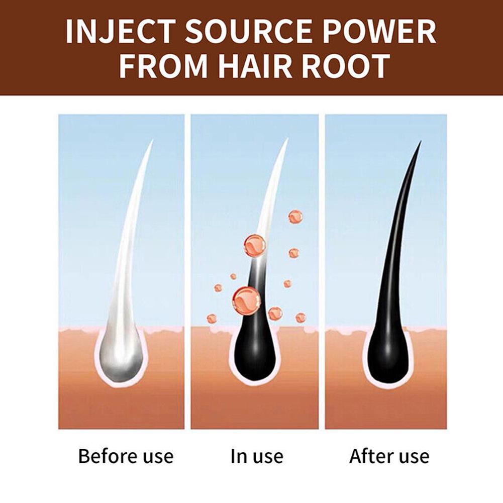 Natural Polygonum Handmade Soa - đánh giá và giá Hair Care Dandruff